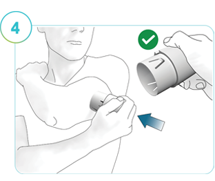  Illustration of Step 4: A person using the applicator to insert the CGM on the prepared application site.