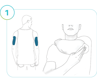  Illustration of Step 1: Application sites highlighted on the back of both arms, an illustration of a person wiping the application site.