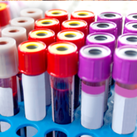 Everything you need to know about HbA1c